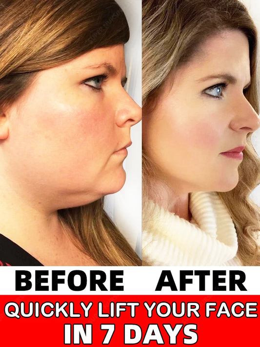 Face Slimming Cream Double Chin Removal