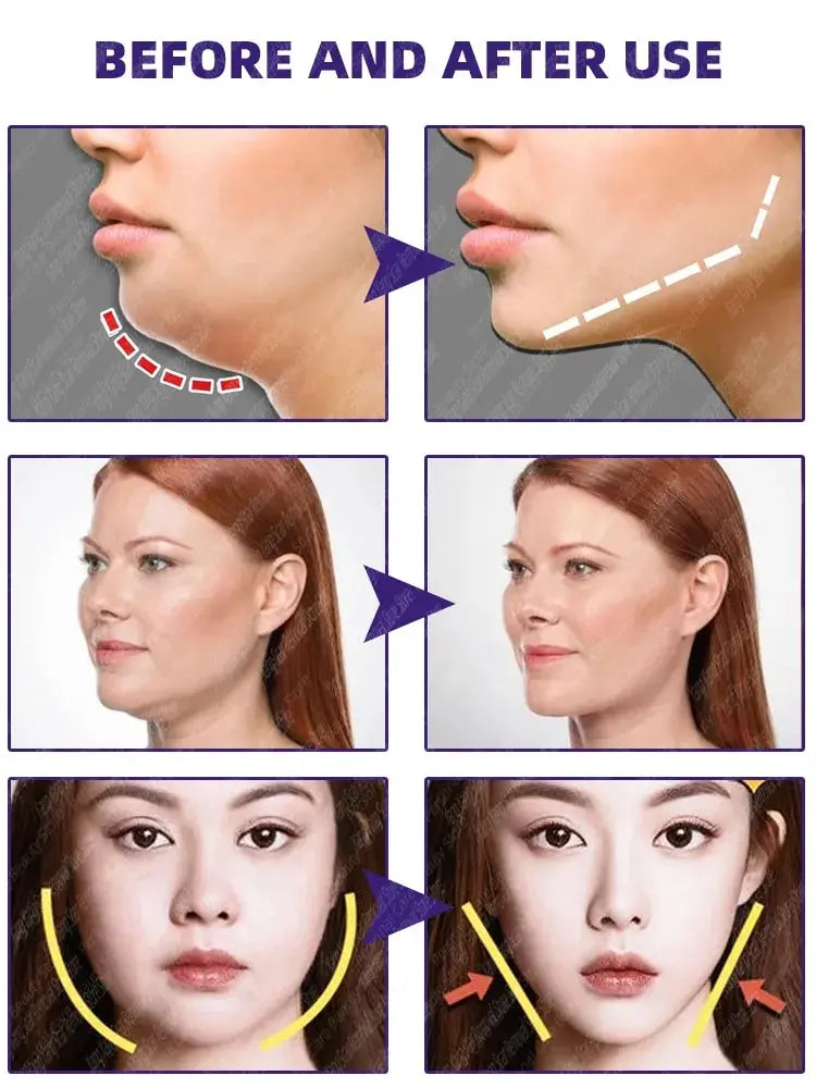 Face Slimming Cream Double Chin Removal